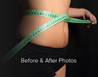 Before and After